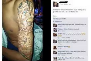 Ingin tampak keren dengan tato, lengan pria ini malah melepuh