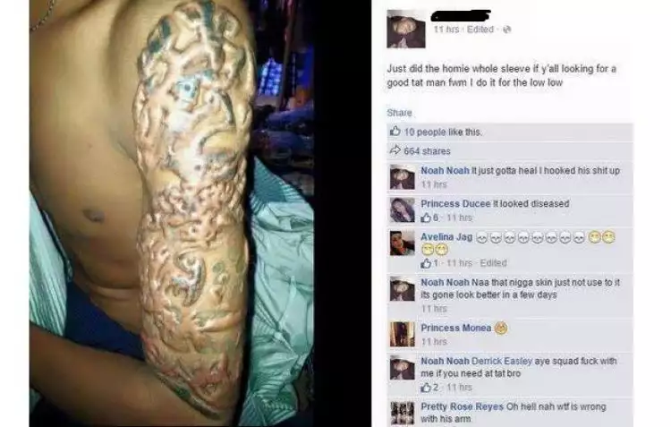 Ingin tampak keren dengan tato, lengan pria ini malah melepuh