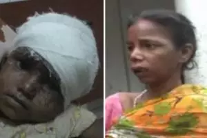 Ibu ini coba makan anaknya sendiri, gigit kuping sampai bercucur darah