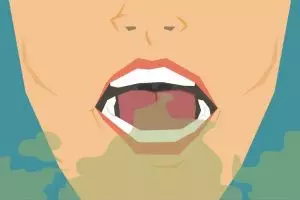 Ini lho yang bikin mulutmu bau setelah bangun tidur