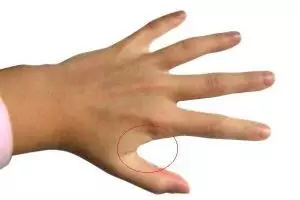 Taruh es batu di area tubuh ini mujarab obati sakit gigi, buktikan!