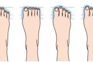 Kepribadian kamu ternyata juga bisa dicermati dari bentuk kaki
