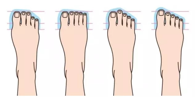 Kepribadian kamu ternyata juga bisa dicermati dari bentuk kaki