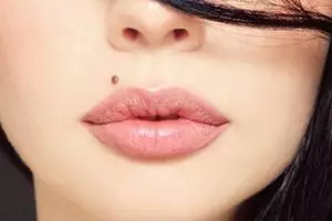 Bahaya kesehatan yang mengintai di balik tahi lalat, seperti apa?