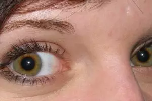 Dari mayat terungkap alasan kenapa kerutan sering muncul di area mata