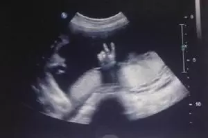 VIDEO: Aksi menakjubkan bayi dalam kandungan, bantu ibunya bernyanyi!