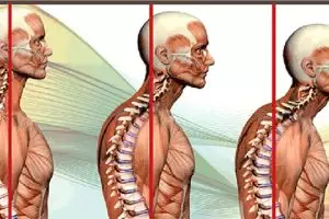 4 Cara jitu atas masalah tulang belakang akibat penggunaan ponsel