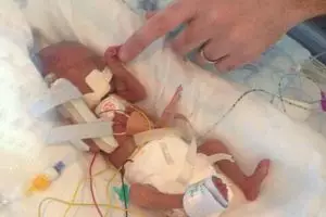 Bayi kelainan plasenta usia 3 pekan dapat bertahan hidup, luar biasa! 