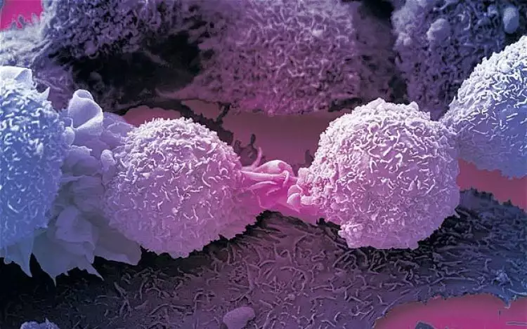 Brilio! Ilmuwan temukan cara mengubah sel kanker menjadi sel normal