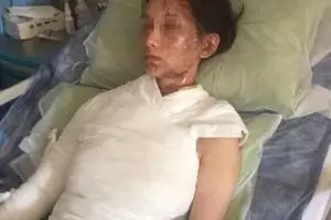 Wanita ini diguyur air panas usai menilai buruk pelayanan restoran