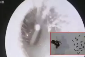 Hiiii! Telinga orang ini jadi tempat menetasnya 25 telur kecoa