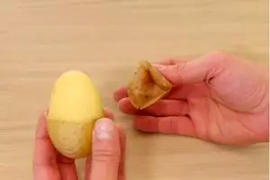 Kulit kentang direkomendasikan dokter dunia untuk atasi luka bakar