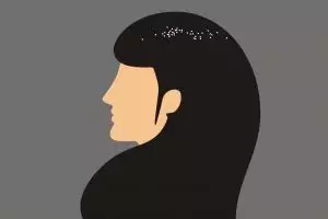 Ketombe suka nempel di rambut? Atasi saja pakai campuran minyak zaitun