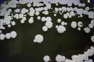 Demi hidup kekal, ilmuwan ini suntikkan 3,5 juta bakteri ke tubuhnya