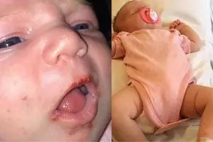 Jangan biarkan bayi dicium orang sembarangan