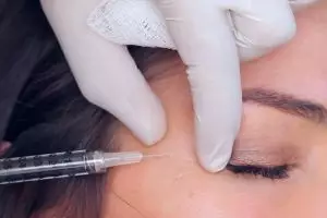 Bukan cuma mengatasi keriput, botox juga mustajab sehatkan mata kamu