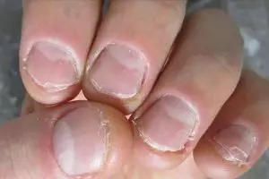 17 Hal yang dirasakan bagi kamu yang punya kuku pendek