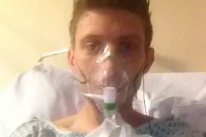 Pakai rokok elektrik, paru-paru pria ini malah berlubang