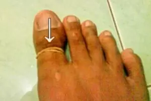 Pengobatan antimainstream ini cuma bisa ditemukan di Indonesia! 