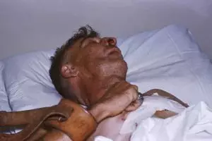 Di balik kelucuannya, kucing bisa tularkan penyakit ini ke manusia