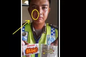 Emosi kena tilang, ibu pengemudi Pajero cakar wajah polisi