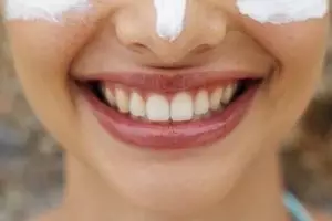 Tips mengatasi kulit gosong sehabis mendaki gunung