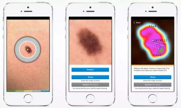  Aplikasi smartphone ini bantu kamu deteksi dini kanker kulit, canggih