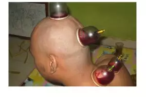 Fakta ini ungkap sebab orang pilih berobat alternatif daripada medis!