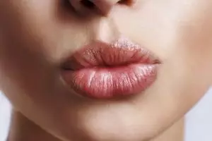 Tak banyak yang tahu, ini cara mudah atasi bibir kering & pecah-pecah