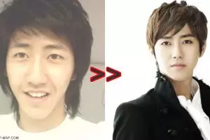 15 Artis Korea ini pernah digosipkan operasi plastik, benarkah?