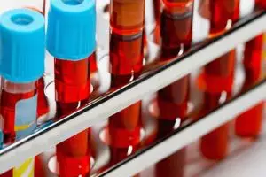 12 Parfum ini baunya nggak lazim sebagai wewangian, kamu berani pakai?