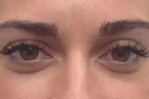 Jarak antar alis ternyata ungkap kepribadianmu, kok bisa?