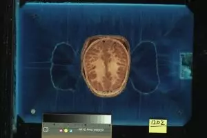 Demi lahirnya manusia virtual, tubuh wanita ini dipotong 5000 bagian