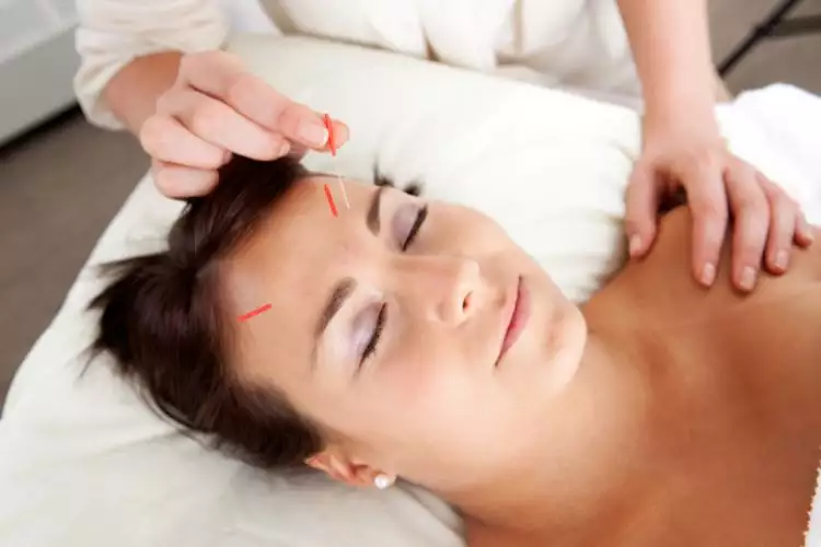 7 Tanda kamu harus coba Akupunktur, sangat mustajab hilangkan sakit!