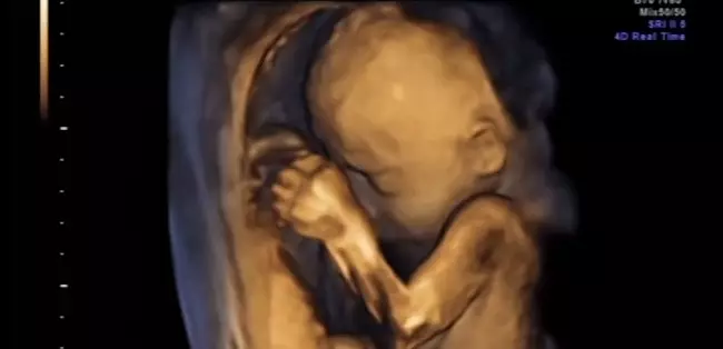 Ibu suka nonton gulat, bayi dalam perut tinju wajah sendiri, wah!