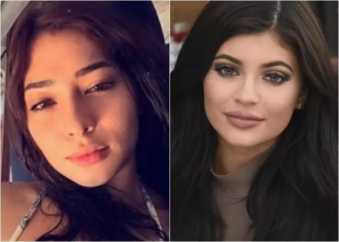 10 Artis cantik ini ternyata punya bibir seksi ala Kylie Jenner, aw!