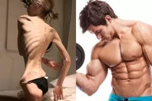 Ini gangguan makan selain anorexia, jangan tunggu dirimu mengalami!