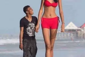 11 Foto ini buktikan cinta tak mengenal fisik, so sweet banget!