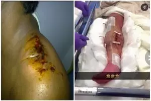 10 Bekas luka ini ngeri banget, bikin ngilu dan tutup mata