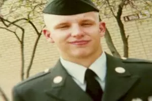 Ini transformasi dari transplantasi wajah korban kecelakaan, ngeri! 