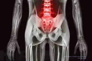 13 Foto hasil sinar rontgen ini membuatmu takjub dengan tubuhmu