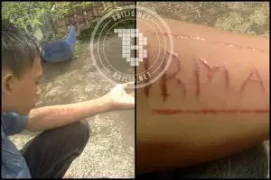 Minta maaf ke pacarnya, bocah ini malah silet tangannya sendiri, duh!