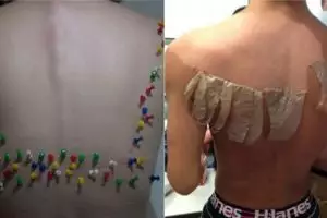 20 Foto 'horor' ini dijamin bikin kamu ngilu dan merinding sendiri! 