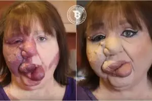 Berkat makeup, wanita ini ubah tanda lahir langka jadi riasan cantik!