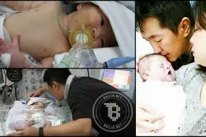 Akhir perjuangan bayi kelainan jantung yang dioperasi berkali-kali