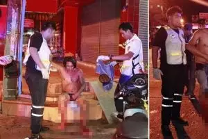 Marah diselingkuhi, istri potong 'burung' suaminya pakai cutter