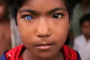 19 Potret orang dengan warna mata yang berbeda sebelah, tahu kenapa?