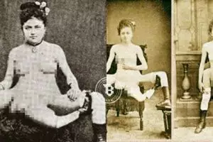 Aneh tapi nyata, wanita ini punya 3 kaki dan 4 payudara