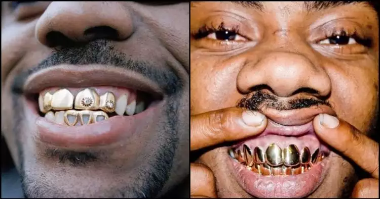 Kawat gigi udah biasa, ini lho penampilan 14 orang pakai gigi emas