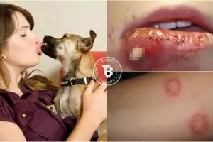 Hati-hati, asal cium anjing bisa tularkan infeksi mematikan!